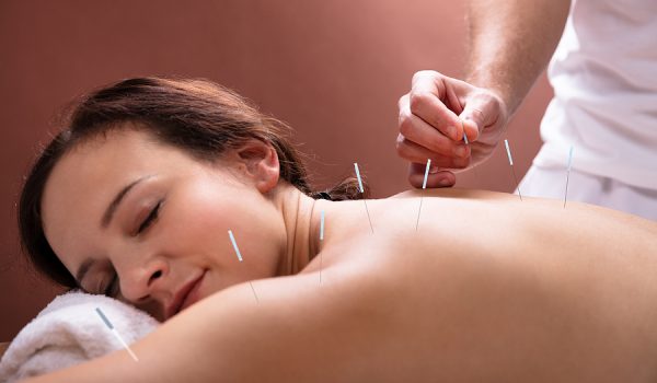 Advantages of Booking an Appointment With a Dry Needling Specialist